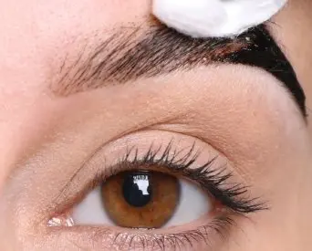 browlift